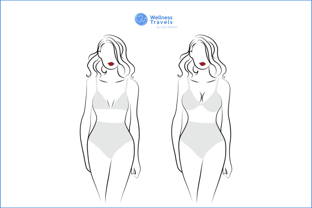 Healthline - Surprise! There's no such thing as normal when it comes to  breast shape and size — they're all unique and totally beautiful! 👐 Visit   for more info on all