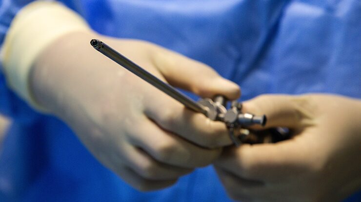 4 mm arthroscope with integrated camera 4 mm arthroscope with integrated camera