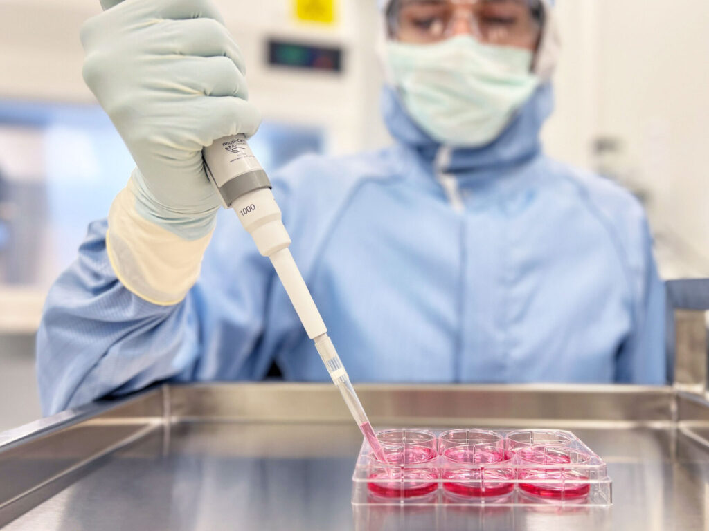 Laboratory preparation of autologous chondrocytes for knee cartilage repair